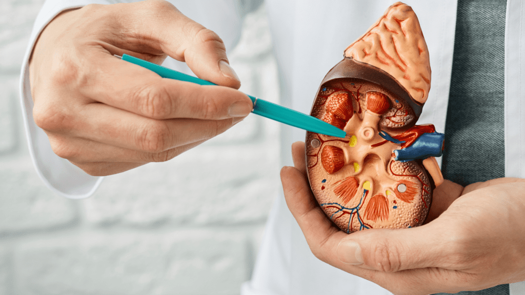 Navigating Kidney Stones A Comprehensive Guide